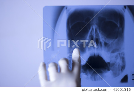 Medical xray face scan 41001516