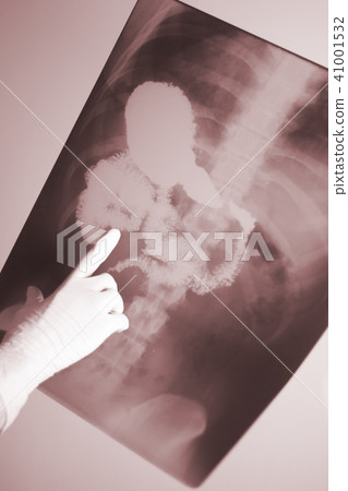 Medical xray spine hip scan Medical xray spine hip scan 41001532