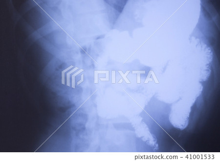 Medical xray spine hip scan 41001533
