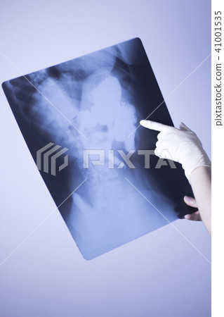 Medical xray spine hip scan 41001535