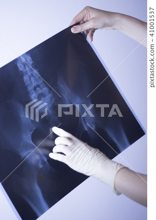Medical xray spine hip scan 41001537