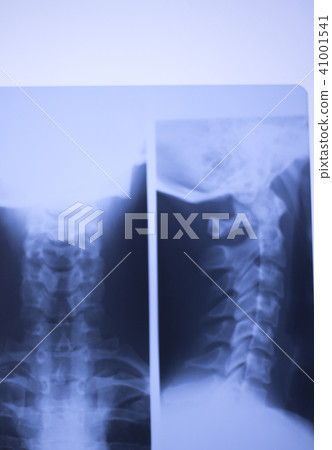Medical xray spine neck scan 41001541