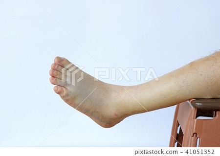 複雜骨折足跟左腿3天 複雜骨折足跟左腿3天 41051352