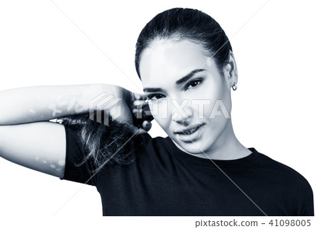 Portrait of beautiful woman with vitiligo in black t-shirt. 41098005