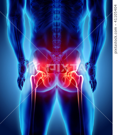 Hip painful skeleton x-ray, 3D illustration. 41105404
