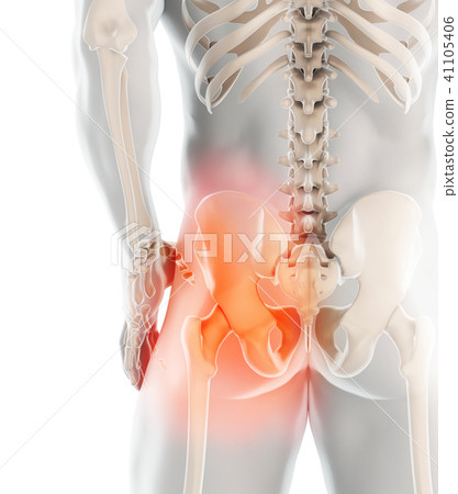 Hip painful skeleton x-ray, 3D illustration. 41105406