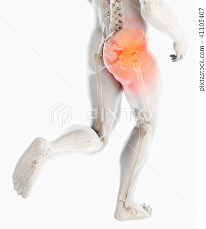 Hip painful skeleton x-ray, 3D illustration. 41105407