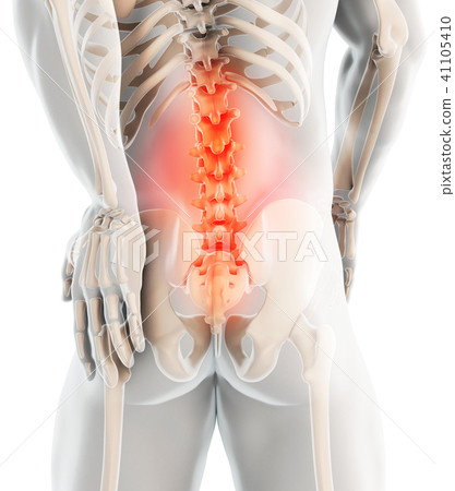 3D Illustration of sacral spine painful. 41105410
