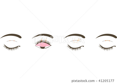 Illustration material of burial method Illustration material of burial method 41205177