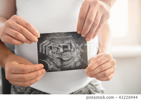 pregnant couple holding ultrasound scan pregnant couple holding ultrasound scan 41228444