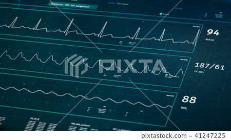 Patient's condition on ICU bedside monitor 41247225