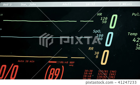 Patient dying, ICU monitor with dropping vital Patient dying, ICU monitor with dropping vital 41247233