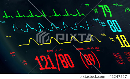 ICU monitor with stable vital signs, doctors ICU monitor with stable vital signs, doctors 41247237