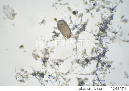 屋塵和蟎蟲 41261074