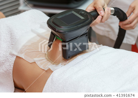 Woman getting cryolipolysis fat treatment Woman getting cryolipolysis fat treatment 41391674