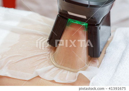 Woman getting cryolipolysis fat treatment Woman getting cryolipolysis fat treatment 41391675