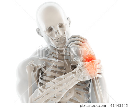 Wrist painful - skeleton x-ray. Wrist painful - skeleton x-ray. 41443345