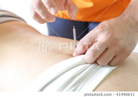 Acupuncture treatment image 41490631