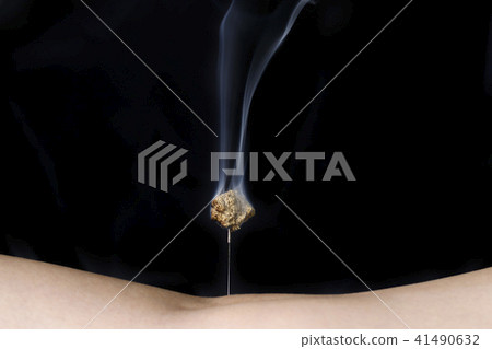 針灸治療圖像 41490632