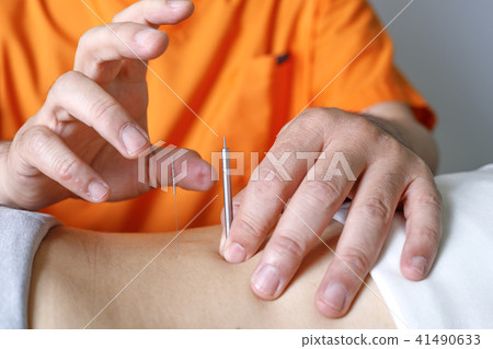 Acupuncture treatment image Acupuncture treatment image 41490633
