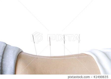 針灸治療圖像 針灸治療圖像 41490635