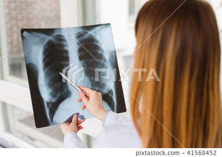 The doctor examines the x-ray image of the patient chest. The doctor examines the x-ray image of the patient chest. 41568452