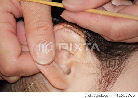 耳朵清潔耳塞 41593709
