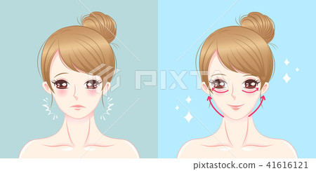 woman with lifting lines 41616121