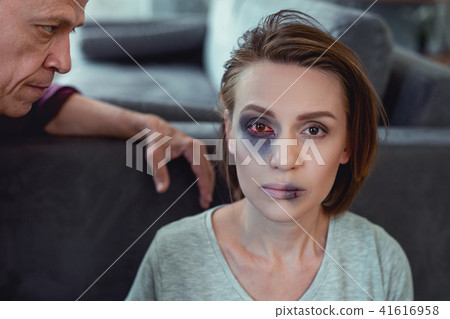 Young dark-haired woman having blue eye after family violence 41616958