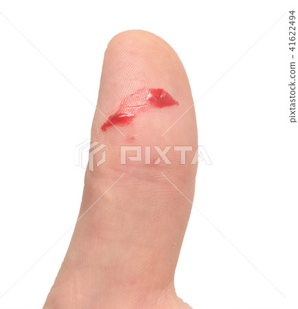 finger with blood 41622494