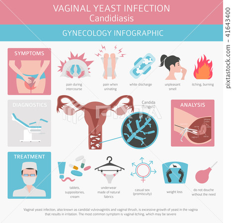 Vaginal yeast infection. Ginecological infographic 41643400