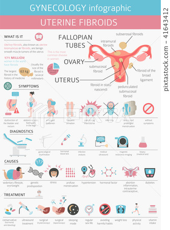 Uterine fibroids. Ginecology medical infographic 41643412