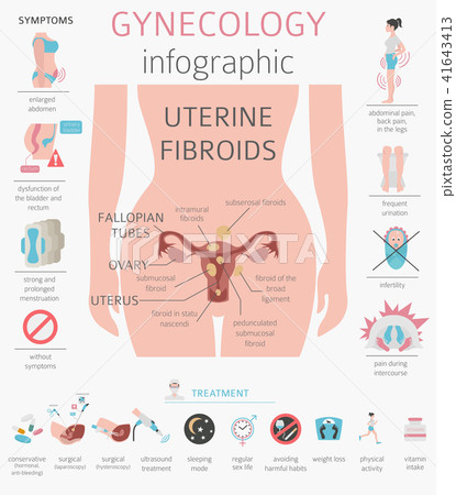 Uterine fibroids. Ginecology medical infographic Uterine fibroids. Ginecology medical infographic 41643413