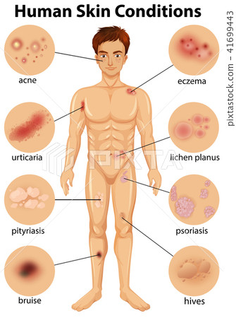 Various human skin conditions Various human skin conditions 41699443