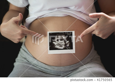 Pregnant woman keeping hand on belly 41750565