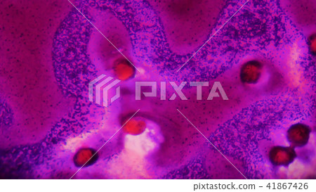 Abnormal blood cell background. Abnormal blood cell background. 41867426