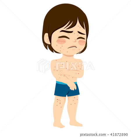 Chicken Pox Boy Chicken Pox Boy 41872890