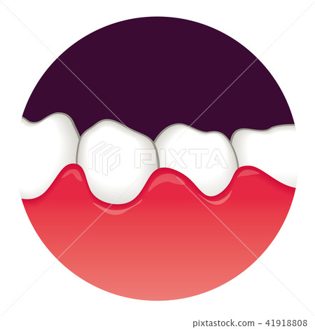 牙齦腫脹牙周病 牙齦腫脹牙周病 41918808