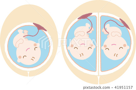 Baby in the womb 3 41951157