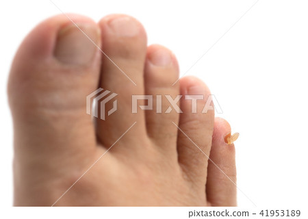 去皮的腳趾爪 41953189