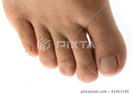 Peeled toe claw 41953190
