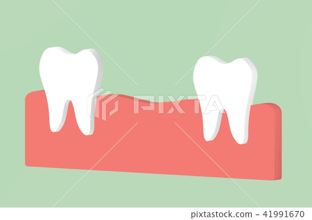 missing tooth, space between teeth in mouth missing tooth, space between teeth in mouth 41991670