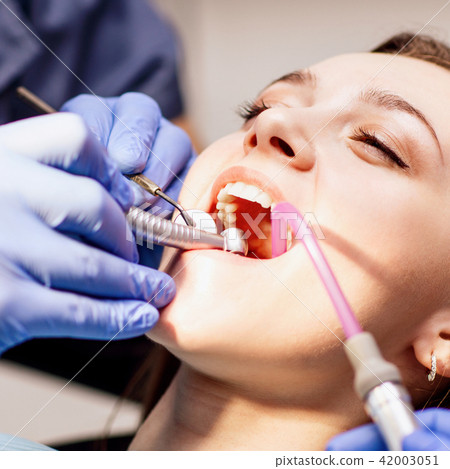 Male dentist treating teeth to young woman patient in clinic. 42003051
