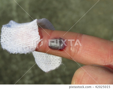 injury 42025015