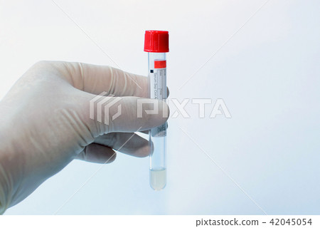 Reagent test 42045054