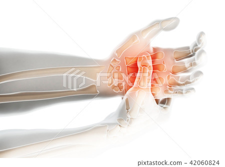 Palm painful - skeleton x-ray, Medical concept. 42060824