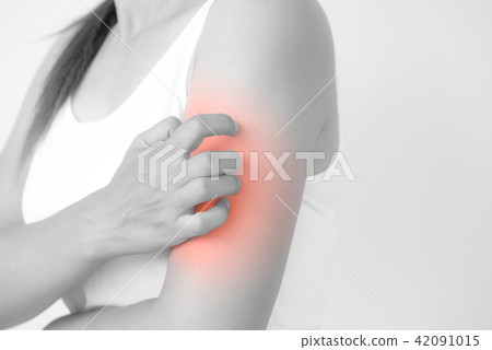 Woman arm scratch the itch by hand at home. Woman arm scratch the itch by hand at home. 42091015