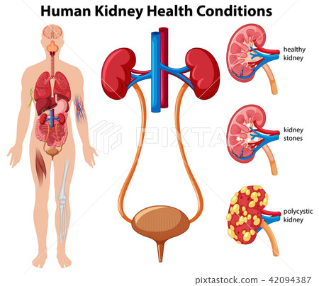 Human Kidney Health Conditions 42094387
