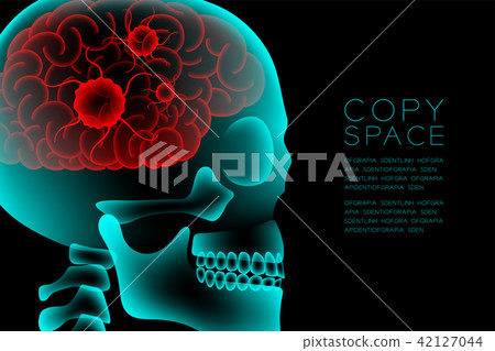 Skull X-ray with Microscope Disease cells in Brain Skull X-ray with Microscope Disease cells in Brain 42127044