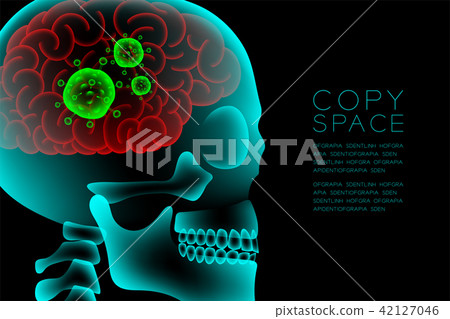 Skull X-ray with Microscope Disease cells in Brain Skull X-ray with Microscope Disease cells in Brain 42127046